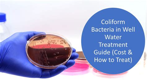 advantages of well water|well water bacteria problems.